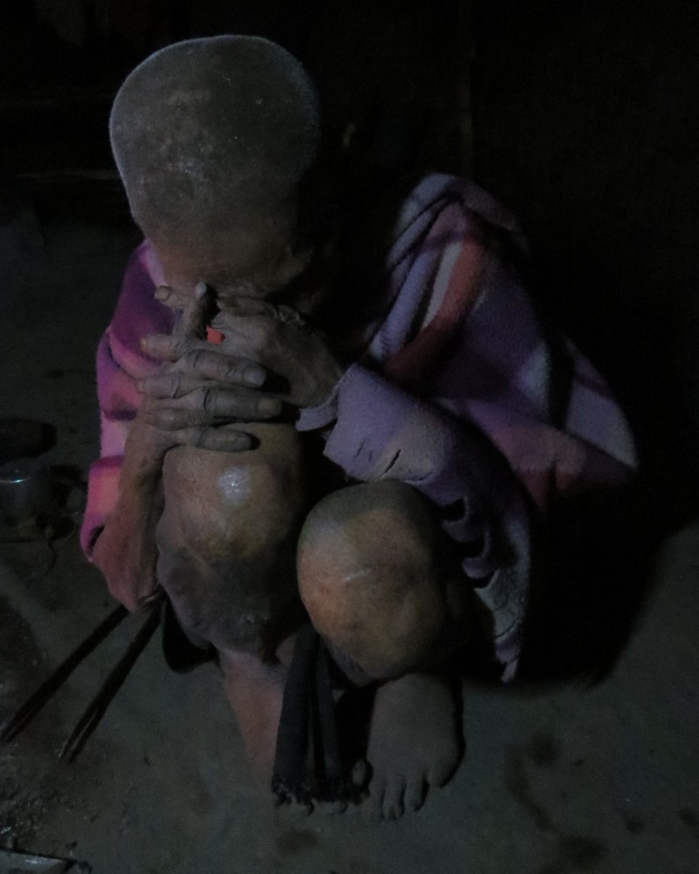 Photo of The Ancient Tattooist of Lungwa Village, Nagaland 6/6 by Sumita Bhattacharya