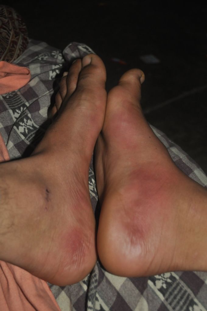 Photo of Feet in bags and shoes on shoulders 11/11 by Yardan Dive
