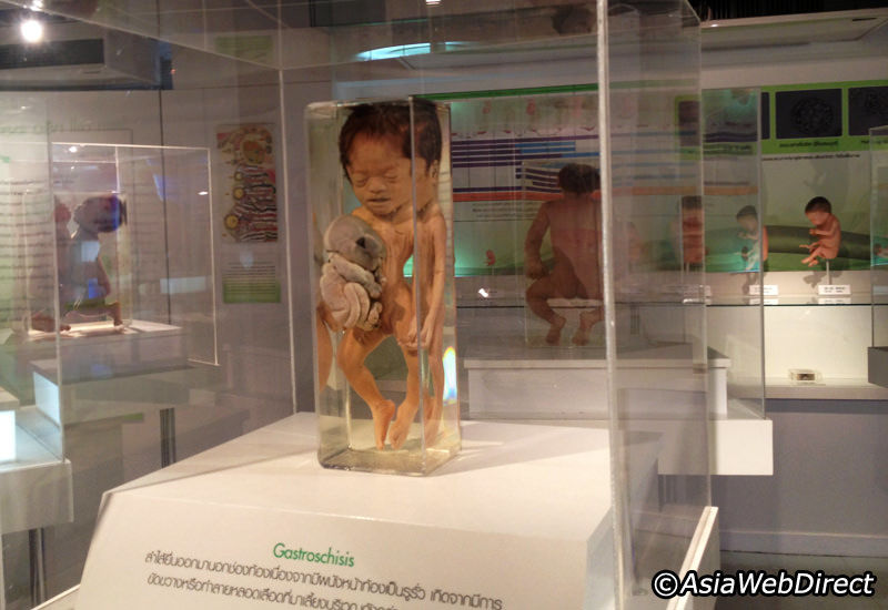 Photo of Siriraj Medical Museum in Bangkok, Thailand: The Eeriest Attraction on Earth by Aahna