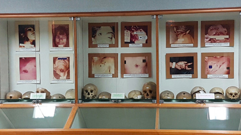 Photo of Siriraj Medical Museum in Bangkok, Thailand: The Eeriest Attraction on Earth by Aahna