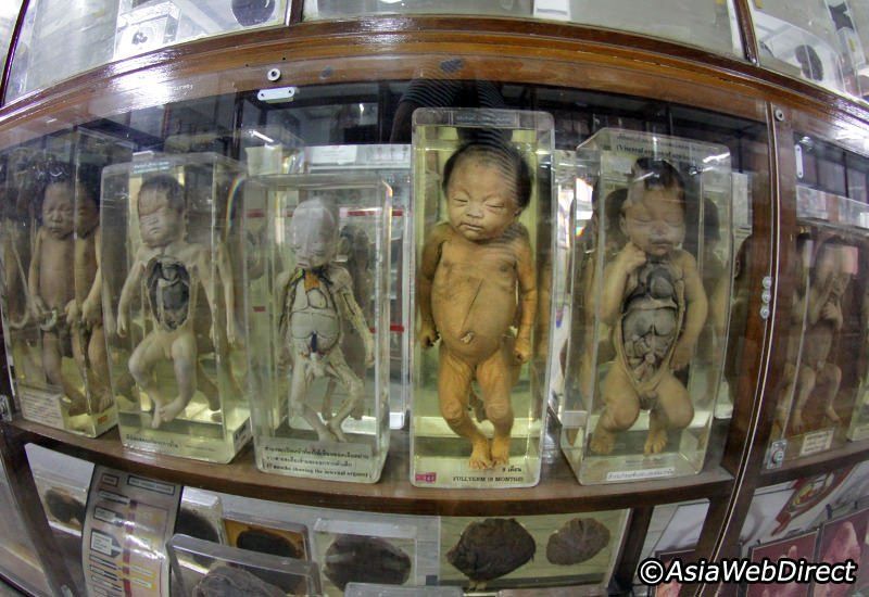 Photo of Siriraj Medical Museum in Bangkok, Thailand: The Eeriest Attraction on Earth by Aahna