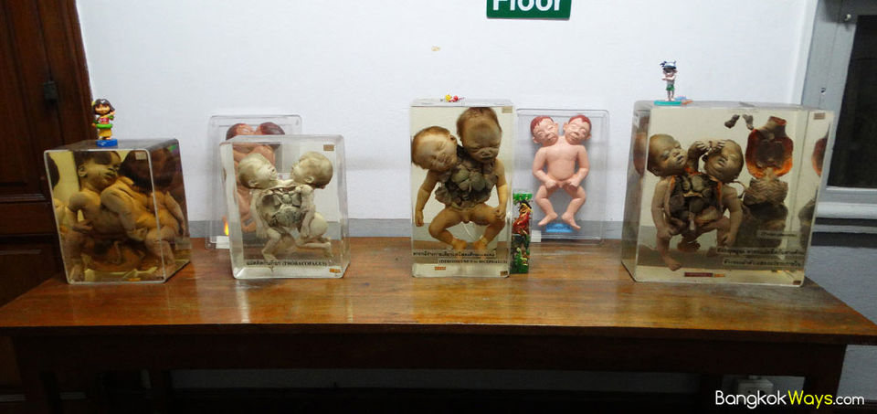Photo of Siriraj Medical Museum in Bangkok, Thailand: The Eeriest Attraction on Earth by Aahna