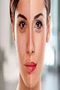 Photo of Revolutionize Your Skincare Routine: Skin Whitening Treatment in Dubai by Hadia Batool
