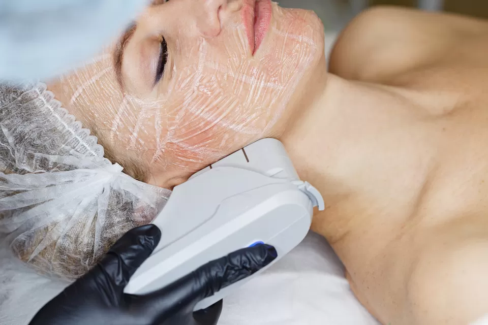 Photo of Embrace the Glow: Ultherapy's Magic Touch in Dubai by Hadia Batool