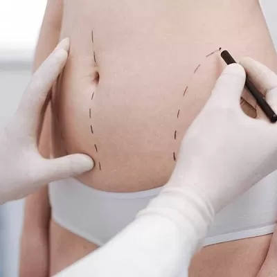 Photo of "Erase Fat, Elevate Confidence: Non-Invasive Techniques in Dubai" by Hadia Batool