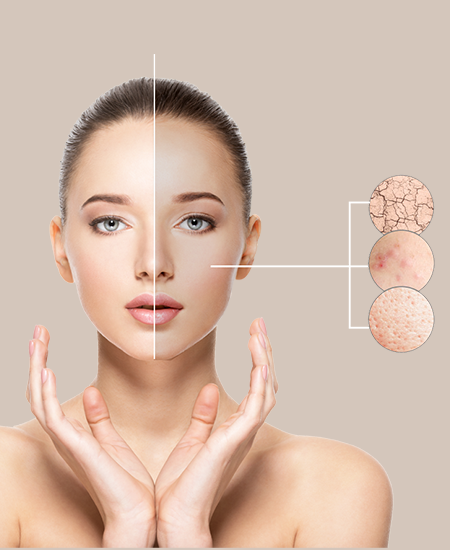 Photo of Your Ticket to Clear Skin: Pimples Treatment Options in Dubai by Hadia Batool