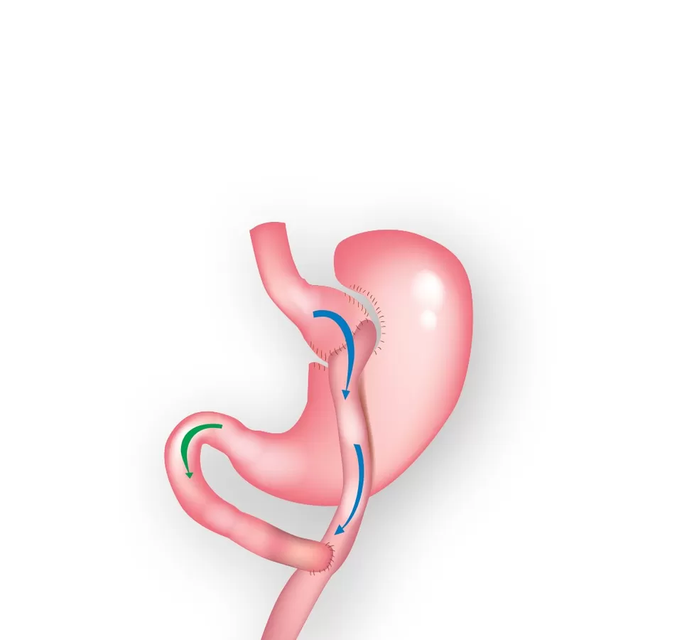 Photo of عيادات جراحة تحويل مسار المعدة المصغرة بأسعار معقولة by Dynamic Clinic