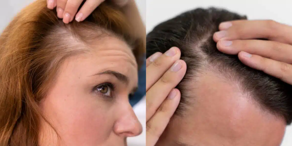Photo of تجربة استنساخ الشعر للحصول على شعر أكثر كثافة وامتلاءً by Dynamic Clinic