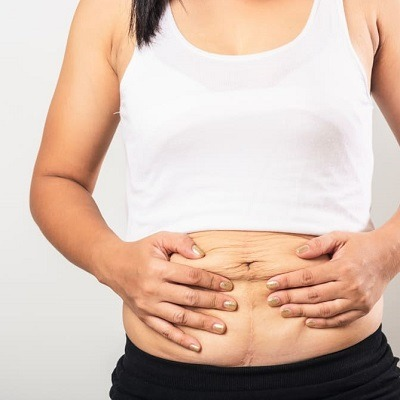 Photo of استمتع بجراحة السمنة الفعالة بتكلفة أقل by Dynamic Clinic