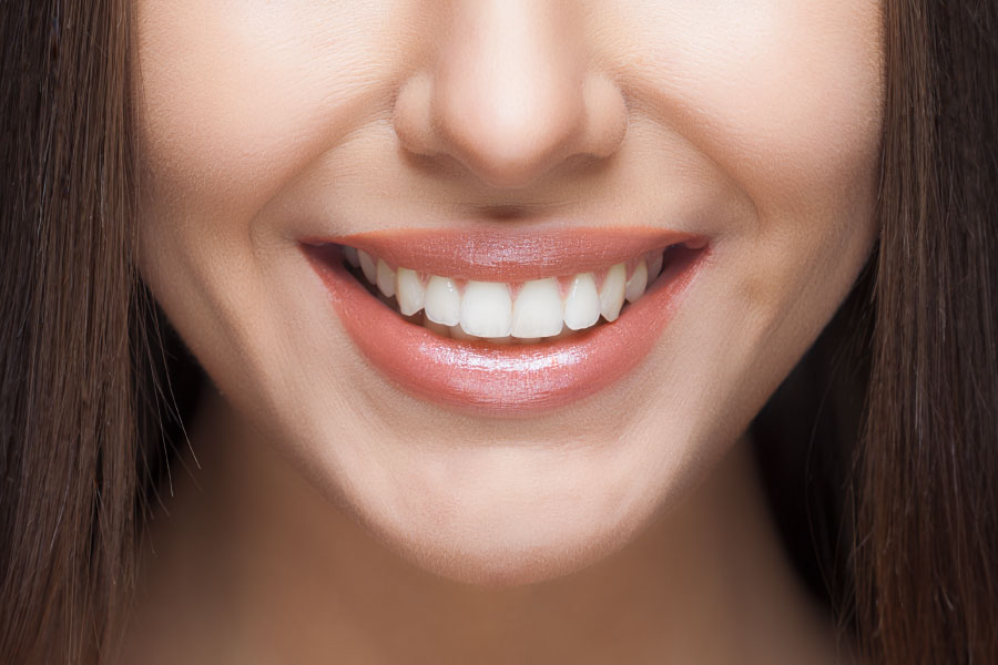 Photo of Laser Teeth Whitening: Benefits by Dynamic Clinic