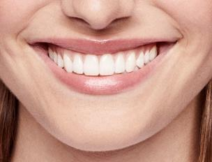 Photo of Overlapping Teeth Solutions: What You Need to Know by Dynamic Clinic