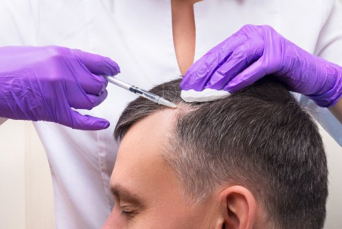 Photo of Is Plasma Injection for Hair Worth? by Dynamic Clinic