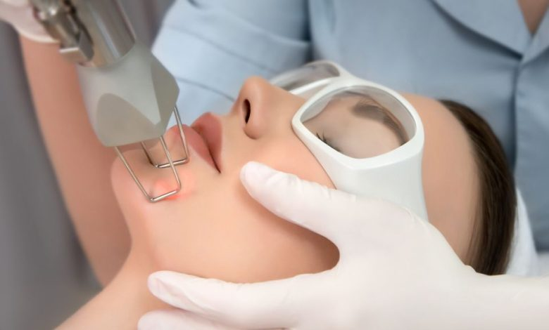 Photo of Is Fractional carbon dioxide Laser Safe for All Skin Types? by Dynamic Clinic