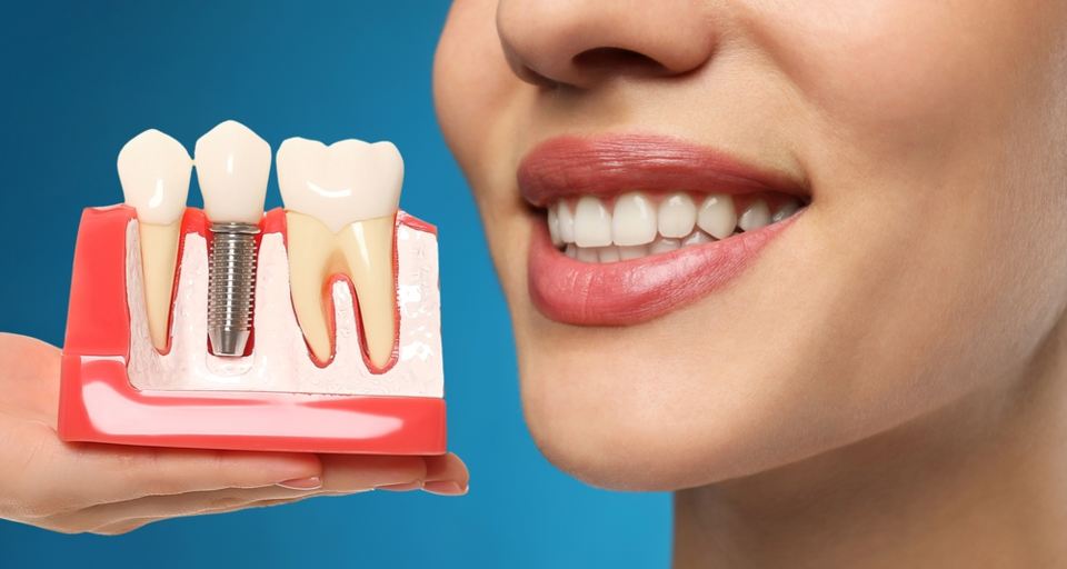 Photo of How Dental Implants are Revolutionizing Oral Health by Dynamic Clinic