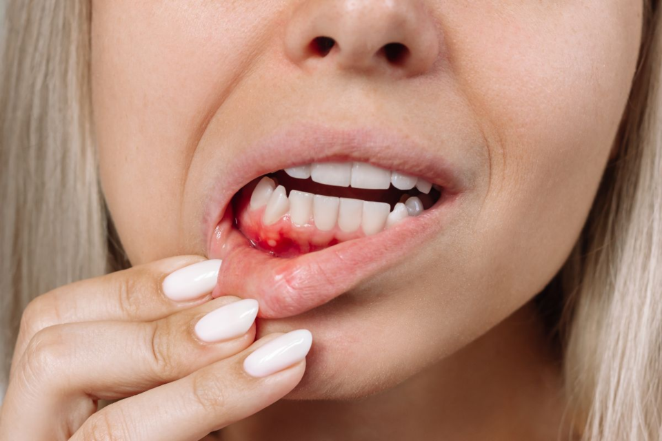 Photo of Prevent and Treat Bleeding Gums: Top Tips by Dynamic Clinic