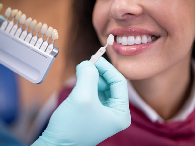 Photo of Top Benefits of Getting Dental Veneers by Dynamic Clinic