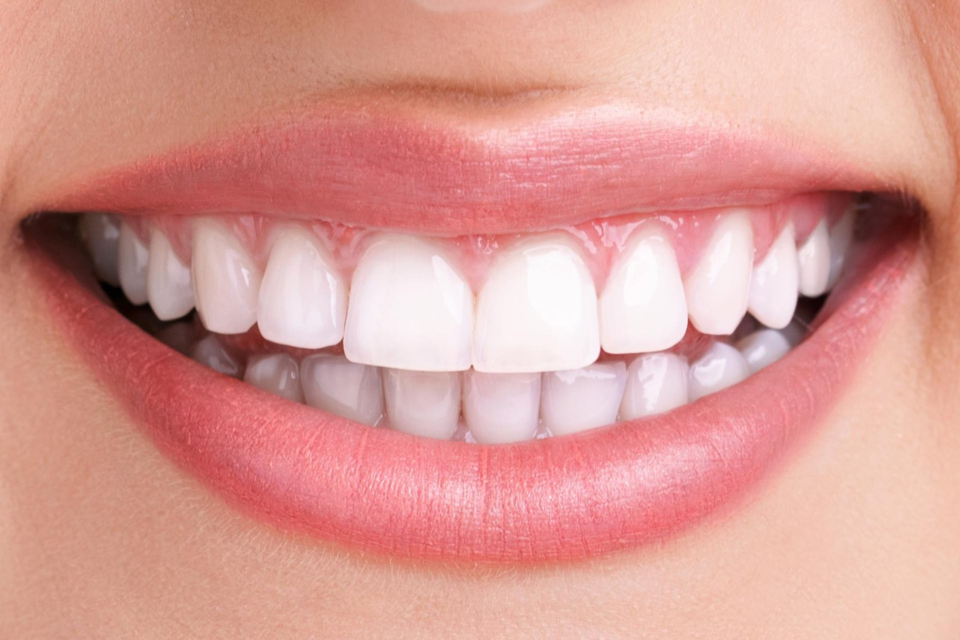 Photo of Achieving a Hollywood Smile: Teeth Whitening Solutions by Dynamic Clinic