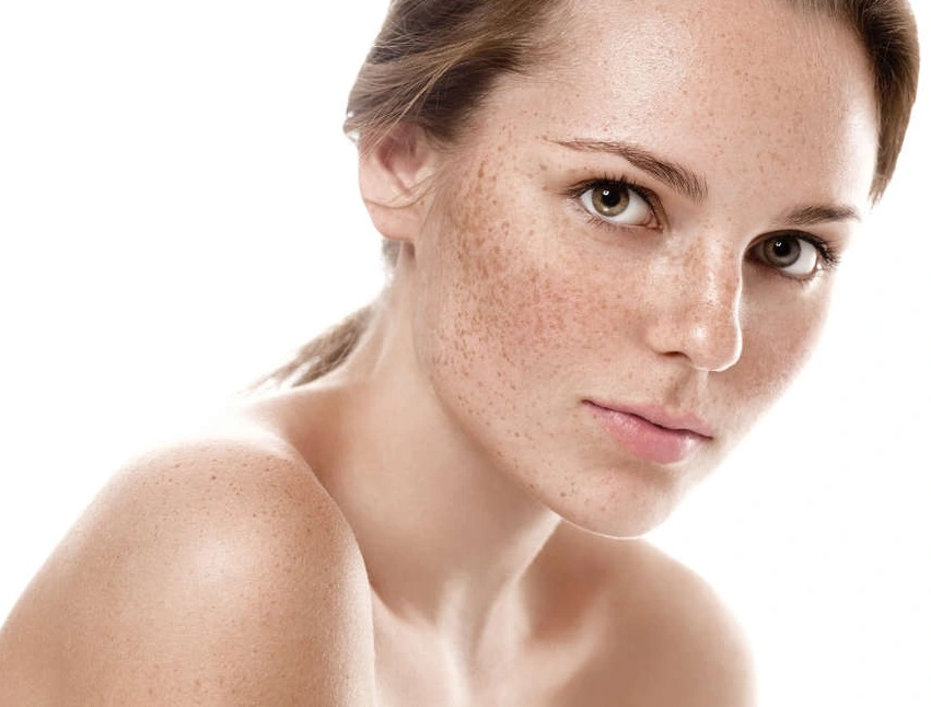 Photo of Non-Surgical Birthmark Treatments: Safe and Effective Solutions by Dynamic Clinic