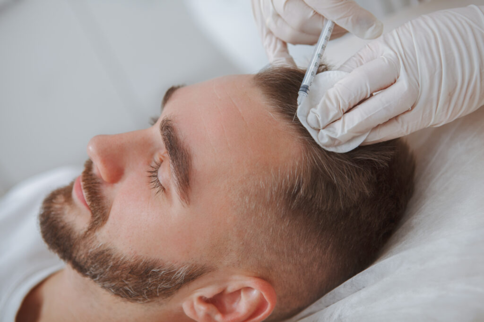 Photo of How Plasma Injection Works for Thinning Hair by Dynamic Clinic