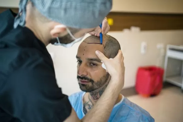 Photo of How Does Stem Cell Hair Transplant Promote Growth? by Dynamic Clinic