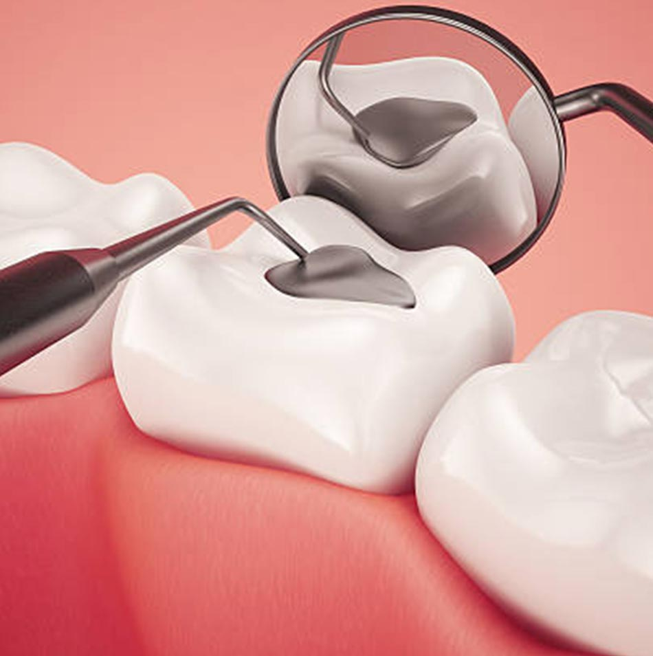 Photo of How Does Dental Filling Improve Oral Health? by Dynamic Clinic