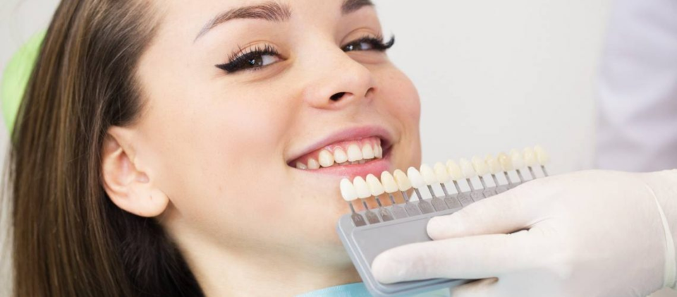 Photo of How Long Do Dental Veneers Last in Daily Use? by Dynamic Clinic