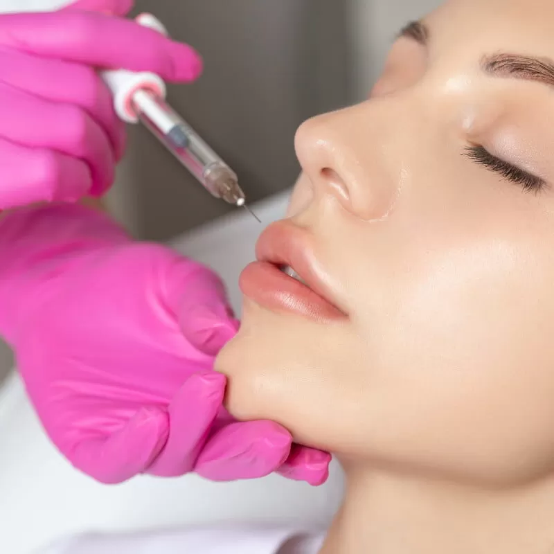 Photo of Exploring the Popularity of Botox Lip Flip in Dubai by Estheticare Dubai
