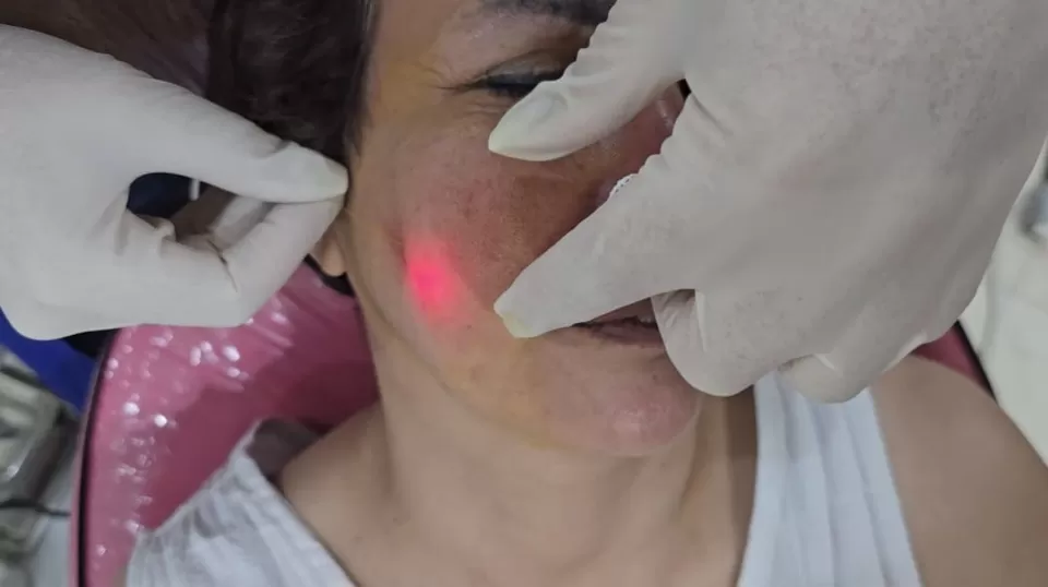 Photo of Achieve a Sculpted Look with Endolift by Muhammad Faizan