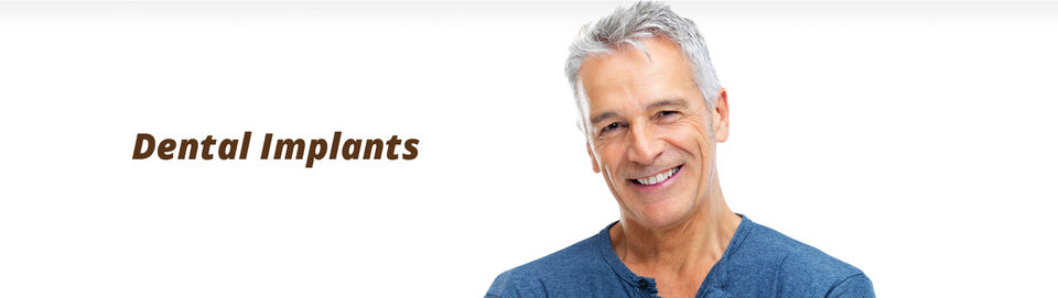 Photo of Dental Implants Idaho Falls 1/1 by Allen Dental