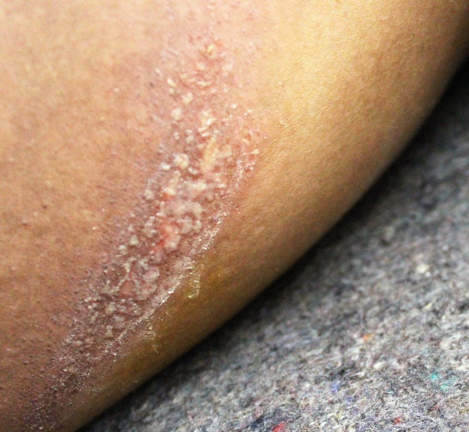Photo of The Ugly side of Lat Maar Holi no one talks about 5/6 by Meghana Sanka