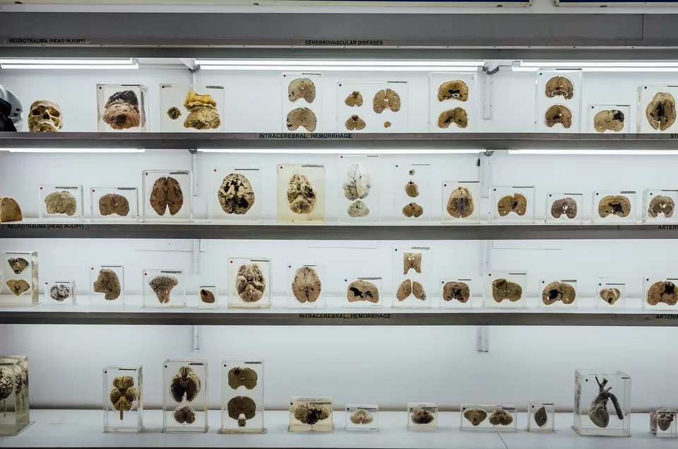Photo of NIMHANS Brain Museum, Lakkasandra, Laljinagar, Wilson Garden, Bengaluru, Karnataka, India by Priya Pareek