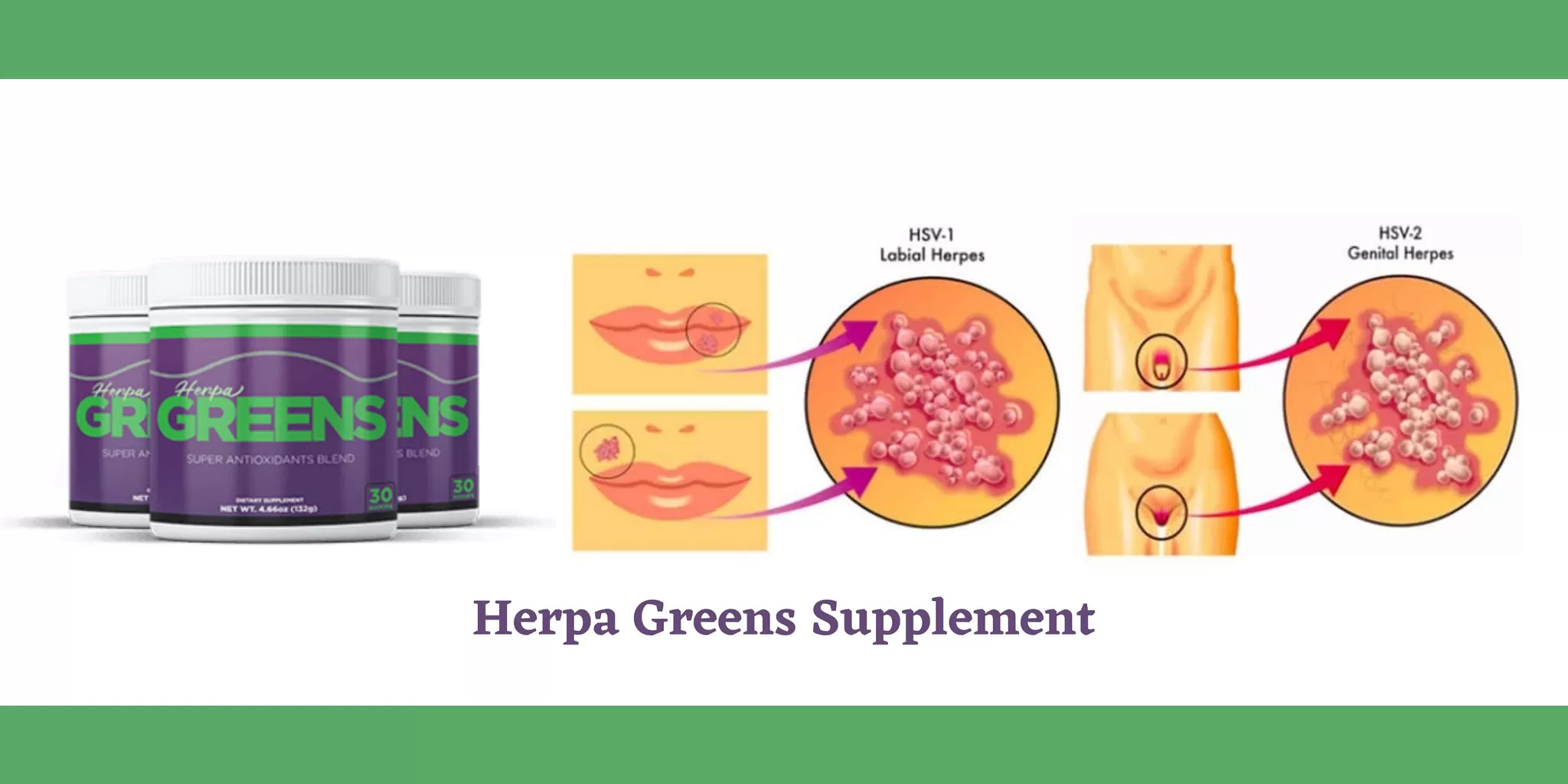 Cover Image of Herpa Greens