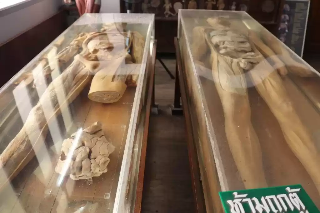 Photo of Death Museum to Cond